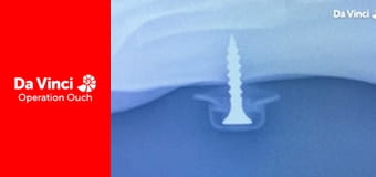 Operation Ouch! - Mouth v Knee