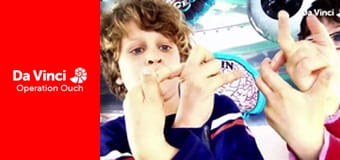 Операция "Ой!" - Первые удивительные органы