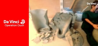 Operation Ouch! - Do Try This at Home - Urine Operation Ouch! - Do Try This at Home - Urine