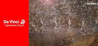 Operation Ouch! - Blink and You'll Miss it! Operation Ouch! - Blink and You'll Miss it!