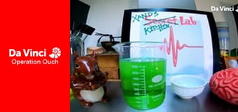 Operation Ouch! - Do Try This at Home - Bacteria Operation Ouch! - Do Try This at Home - Bacteria