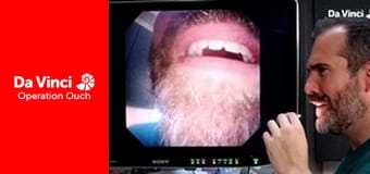 Операция "Ой!"! - Сделайте это дома - Глаза Операция "Ой!"! - Сделайте это дома - Глаза