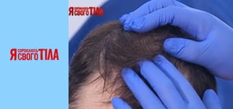 Я соромлюсь свого тіла - Сезон 5 Випуск 17 Частина 9