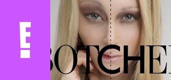 Botched S1E7 - Girls Gone Wildd Botched S1E7 - Girls Gone Wildd