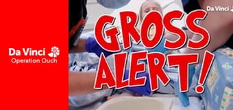 Operation Ouch! - Poo-Tastic!