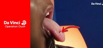 Операция "Ой!" - Глазная буффонада!