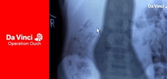 Операция "Ой!" - от укачивания до крепкого сна Операция "Ой!" - от укачивания до крепкого сна