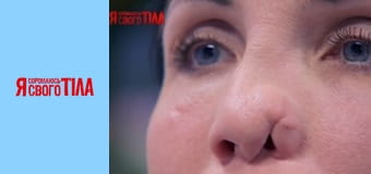 I'm Ashamed of My Body - Season 6 Episode 13 Part 3