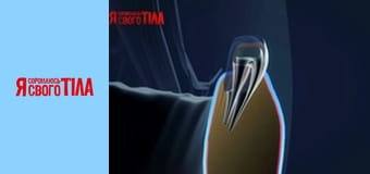 Я соромлюсь свого тіла - Сезон 3 Випуск 8 Частина 4