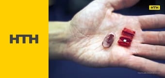 "Случайный свидетель".