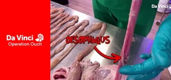 Operation Ouch! - Totally Gross! Operation Ouch! - Totally Gross!