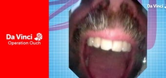 Операція "Ой!"! - Зробіть це вдома - Відбитки пальців