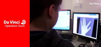 Operation Ouch! - Use Your Eardrum and Listen to the Radio Operation Ouch! - Use Your Eardrum and Listen to the Radio