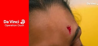 Operation Ouch! - Doctors Face Off! Operation Ouch! - Doctors Face Off!