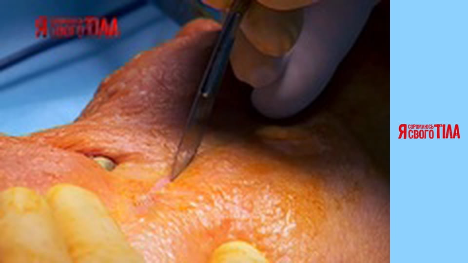 Я соромлюсь свого тіла - Сезон 4 Випуск 10 Частина 5