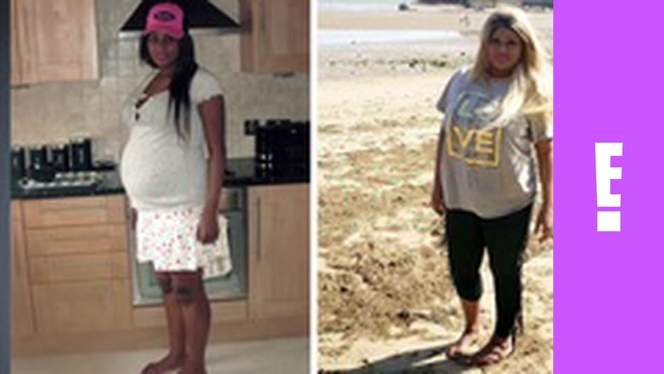 Botched S5E6 - Nothing Butt Trouble