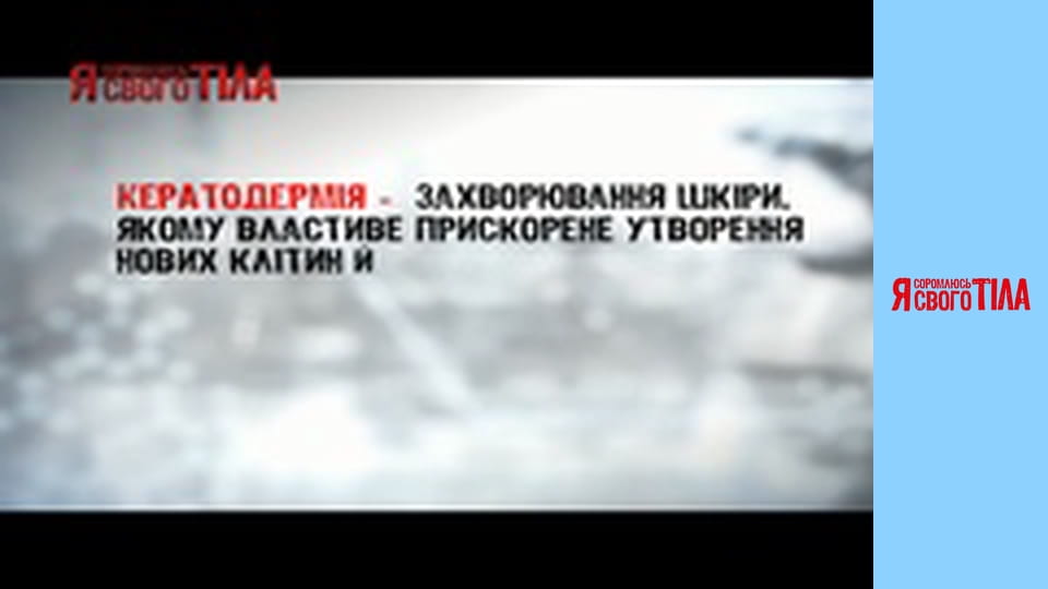 Я соромлюсь свого тіла - Сезон 1 Випуск 12 Частина 3