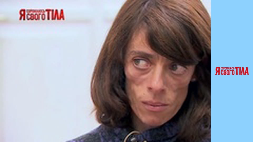 I'm Ashamed of My Body - Season 4 Episode 1 Part 3