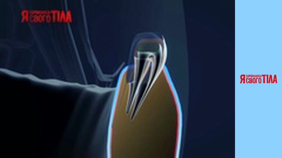 Я соромлюсь свого тіла - Сезон 3 Випуск 8 Частина 4