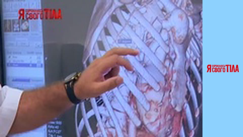 Я соромлюсь свого тіла - Сезон 4 Випуск 5 Частина 1