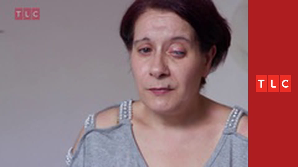 Italská klinika pro obézní S3E3