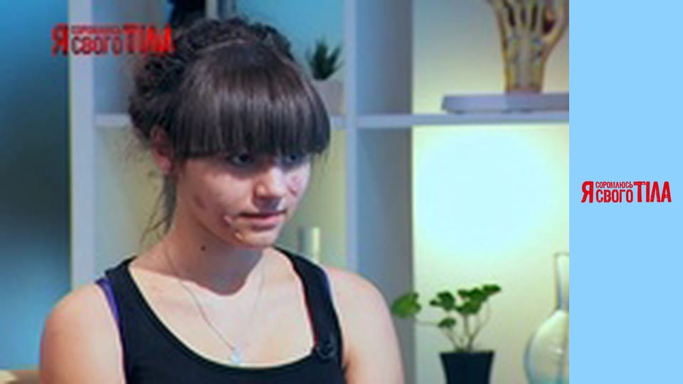 Я соромлюсь свого тіла - Сезон 3 Випуск 6 Частина 1