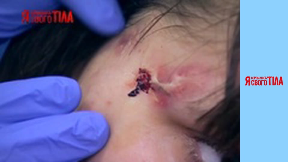 Я соромлюсь свого тіла - Сезон 3 Випуск 6 Частина 2