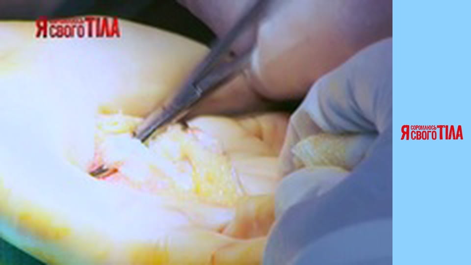 I'm Ashamed of My Body - Season 3 Episode 6 Part 5