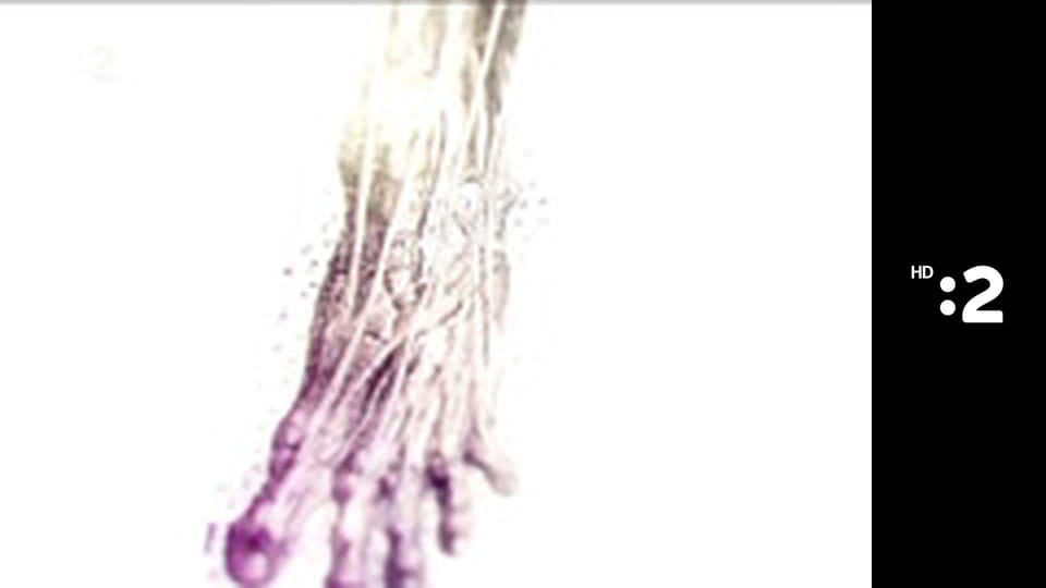 Moja diagnóza E23 - 30 rokov laserových operácií na Slovensku