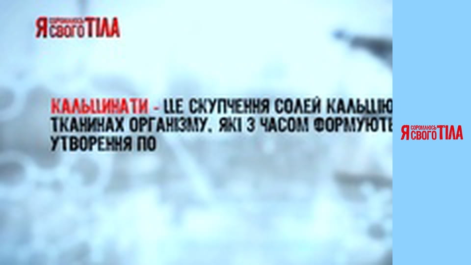 Я соромлюсь свого тіла - Сезон 3 Випуск 7 Частина 4