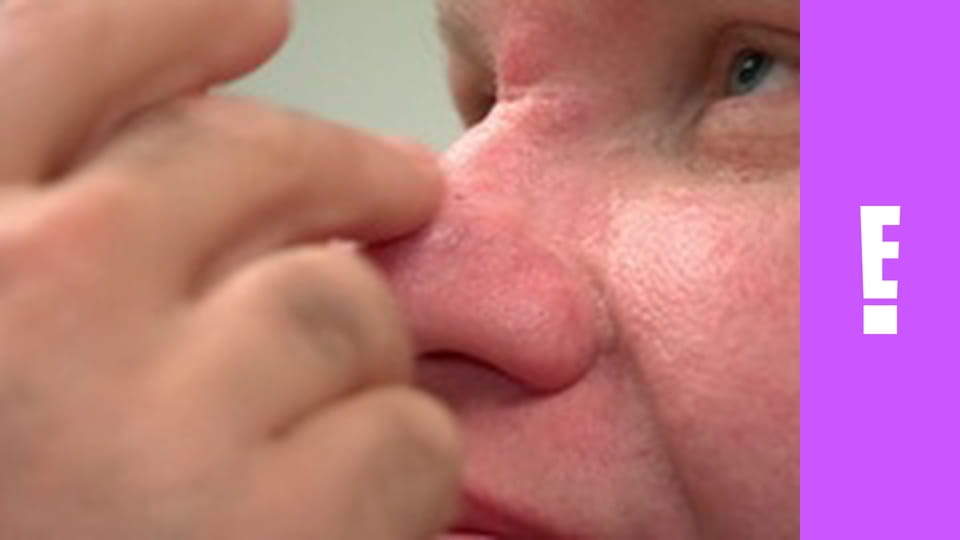 Botched S3E4 - Double D-isaster