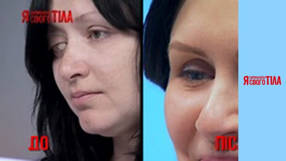 Я соромлюсь свого тіла - Сезон 3 Випуск 12 Частина 1