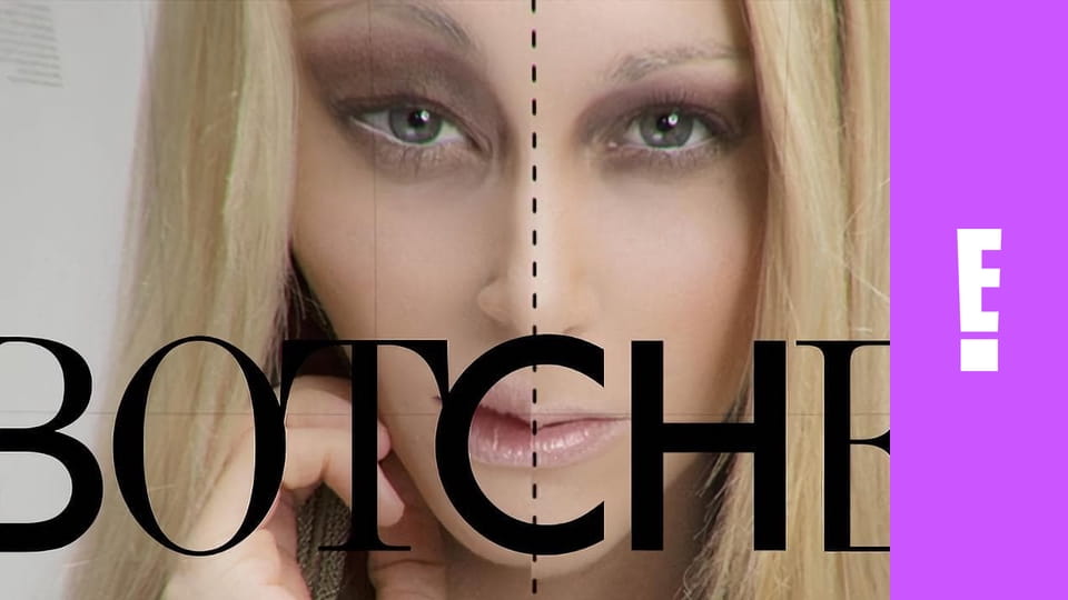 Botched S1E6 - Boob Freak!