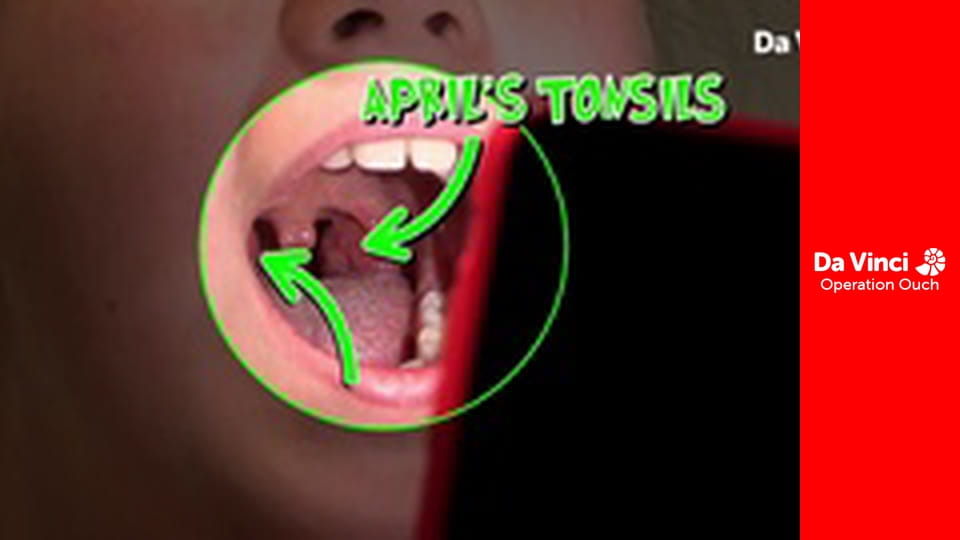 Операція «Ой!» - Сила щелепи і пожива для розуму