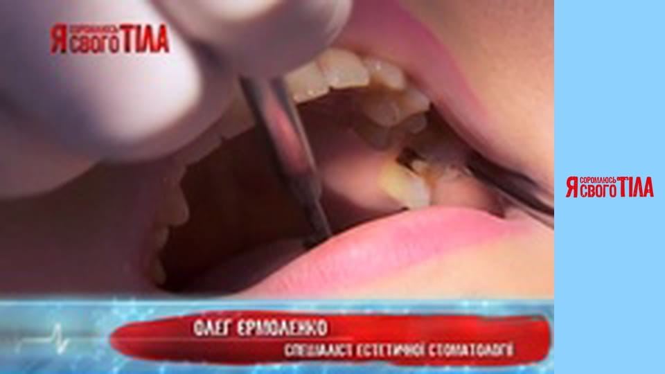 Я соромлюсь свого тіла - Сезон 4 Випуск 17 Частина 4