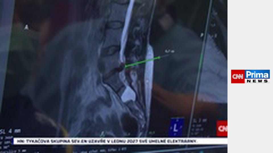 K věci - Jan Bartošek