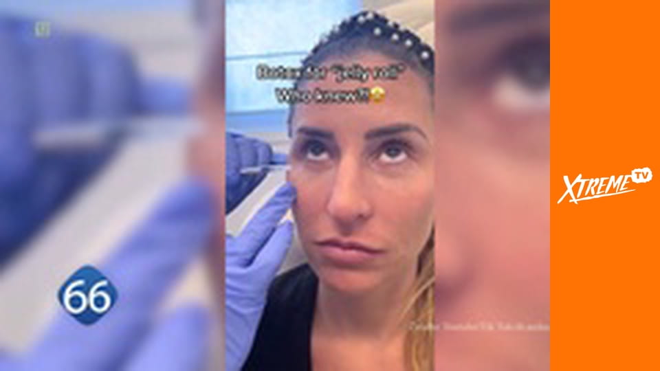 77 TV E13 - Przypadki modowe i zaskakujących trendów