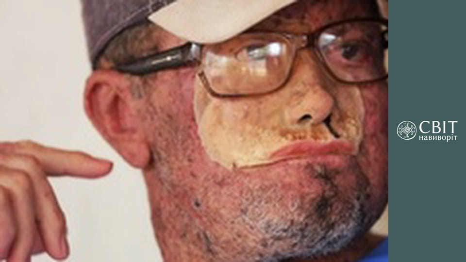 Season 10, Episode 29, Brazil