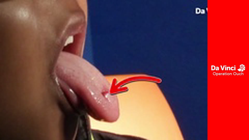 Операция "Ой!" - Глазная буффонада!