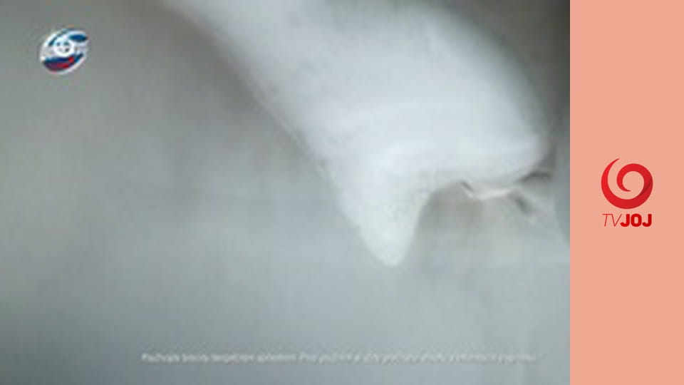 Informácie pre tipujúcich