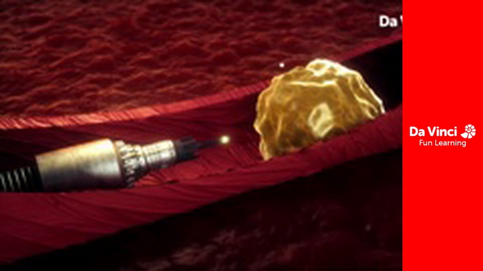 A World Without NASA - The Pulse of Tech