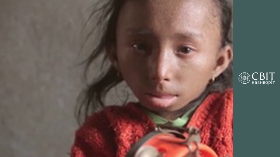 Сезон 8, Выпуск 4, Непал