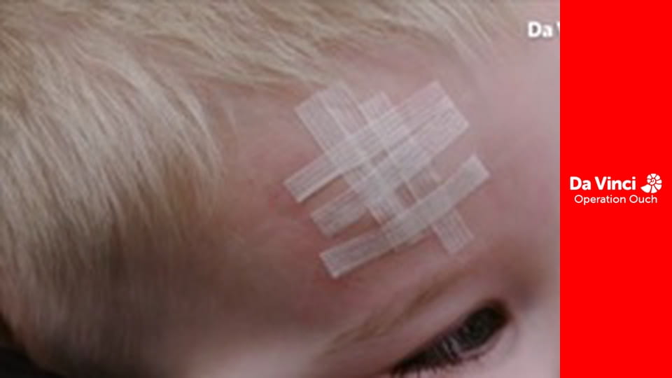 Операція «Ой!» - Героїчний гіпокамп