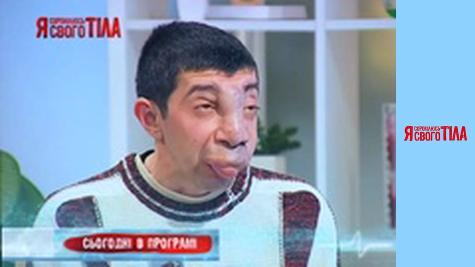 Я соромлюсь свого тіла - Сезон 3 Випуск 17 Частина 1