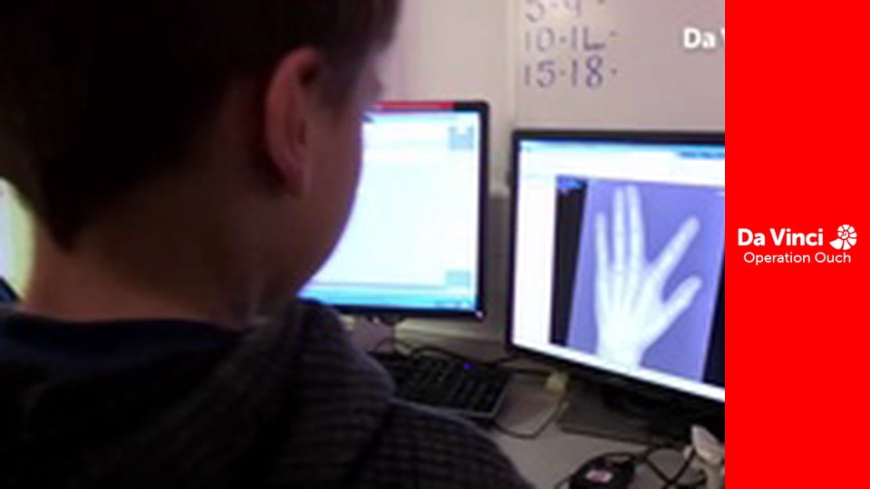 Операція «Ой!» - Використовуйте свою барабанну перетинку і слухайте радіо