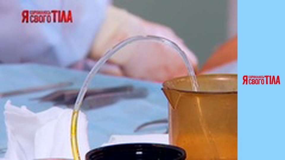 Я соромлюсь свого тіла - Сезон 6 Випуск 8 Частина 7