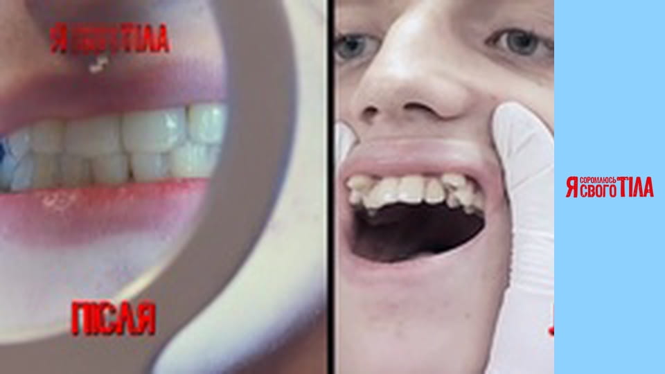 I'm Ashamed of My Body - Season 5 Episode 4 Part 7