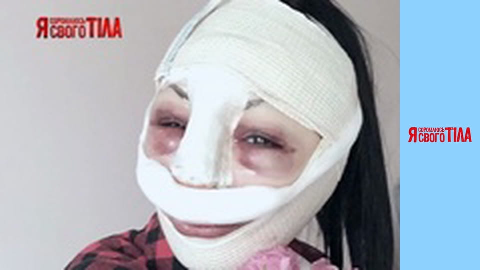 Я соромлюсь свого тіла - Сезон 3 Випуск 13 Частина 5