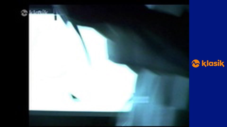 Pohotovosť S4E20 - O ľútosti minulej a strachu budúcom