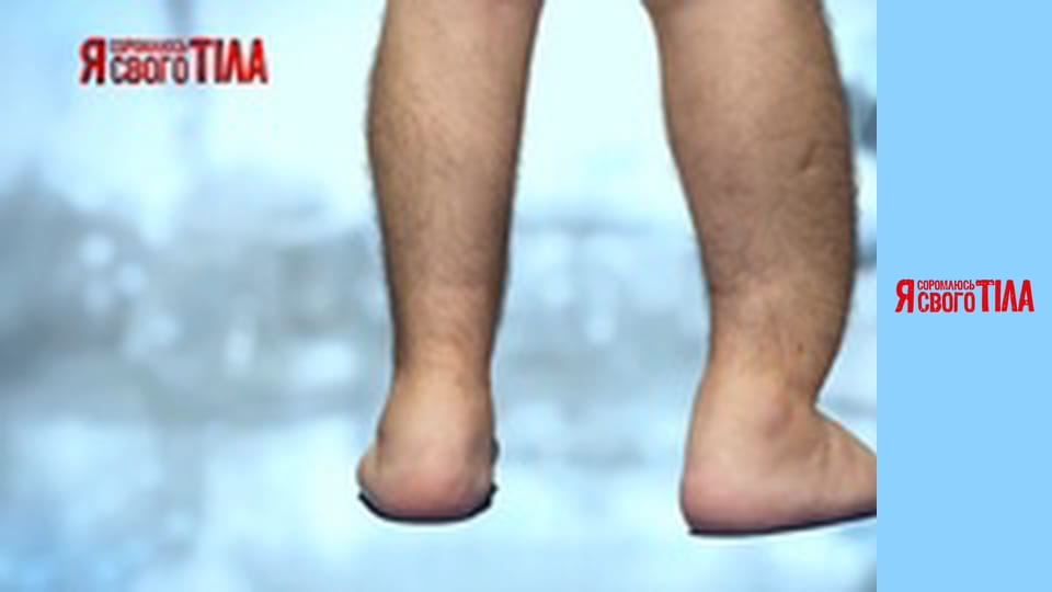 Я соромлюсь свого тіла - Сезон 3 Випуск 10 Частина 3